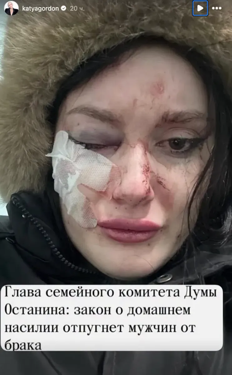 Фото Екатерины Гордон